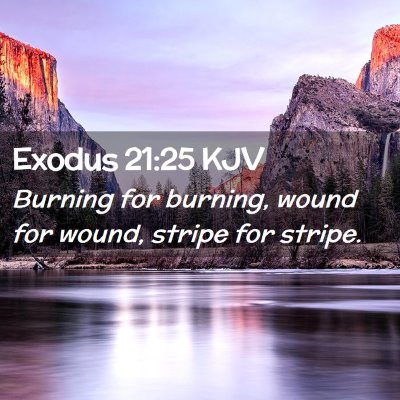 Picture 02 - Exodus 21:25 KJV - Burning for burning, wound for wound, stripe for - Bible Verse Picture