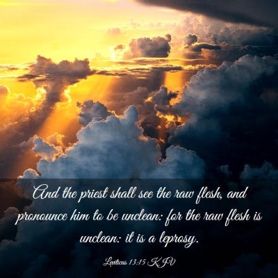 Picture 03 - Leviticus 13:15 KJV - And the priest shall see the raw flesh, and - Bible Verse Picture
