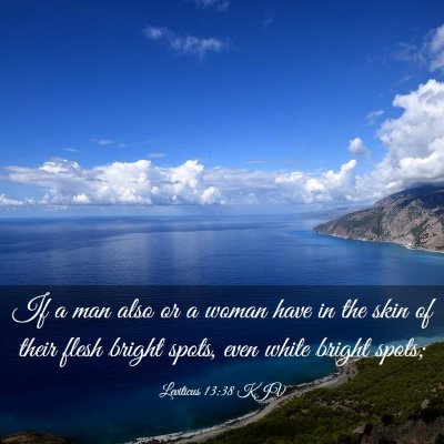 Picture 03 - Leviticus 13:38 KJV - If a man also or a woman have in the skin of - Bible Verse Picture
