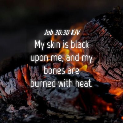 Picture 04 - Job 30:30 KJV - My skin is black upon me, and my bones are burned - Bible Verse Picture